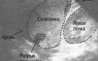 Боль в правом подреберье при кашле причины и возможные заболевания