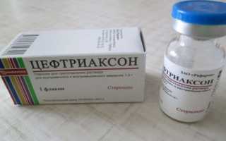 Пневмония у детей: симптомы и осложнения бронхита, лечение, профилактика