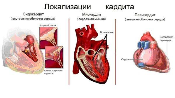 Боль в правом подреберье при кашле причины и возможные заболевания