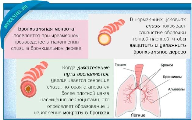 бронхиальная мокрота