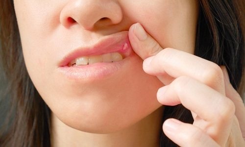 Деринат для ингаляций небулайзером