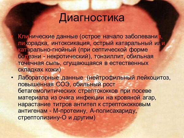 Диагностика при скарлатине