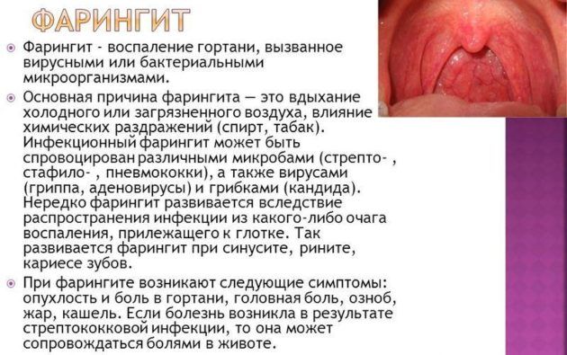 Фарингит так же может провоцировать неприятные звуки при глотании