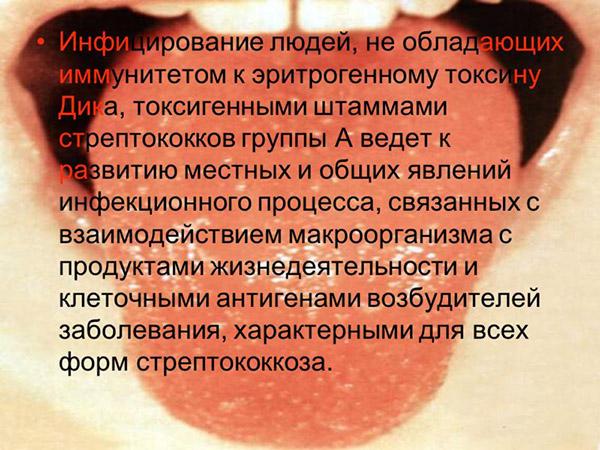 Инфицирование людей скарлатиной