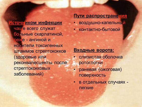Источники инфекции и пути распространения скарлатины