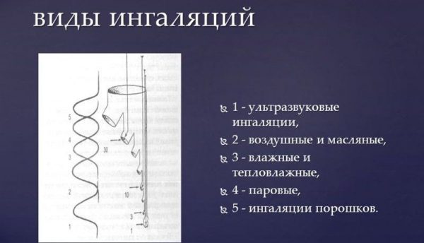Каланхоэ сок при гайморите