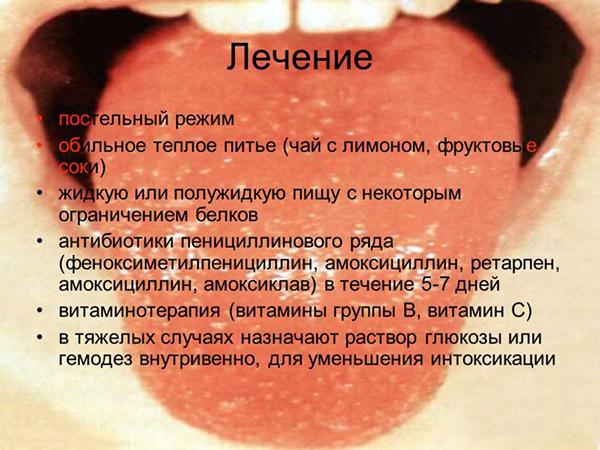 Лечение скарлатины