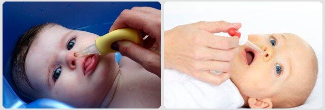 Массаж при гайморите в домашних условиях