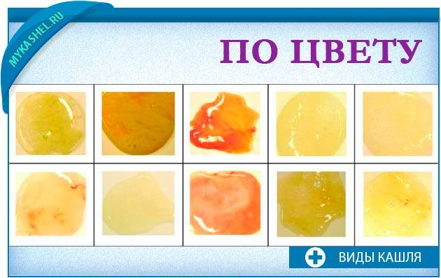 мокрота разных цветов
