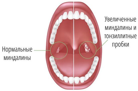 Норма и заболевание