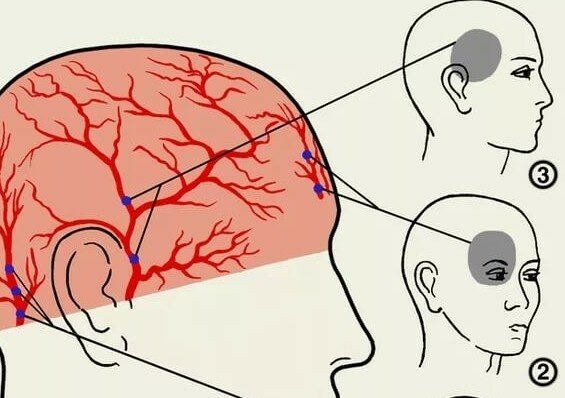 болит голова внутри за глазами