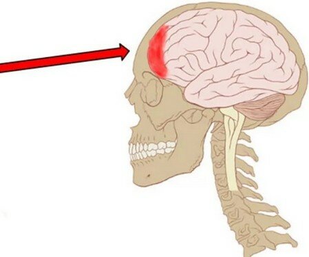 Отчего болит голова лобная часть