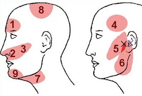 очень сильно болит голова в области висков давит