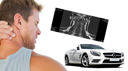 Вот почему болит спина и шея в машине Вот почему болит спина и шея в машине