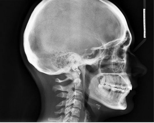 Болит голова когда встаешь и садишься