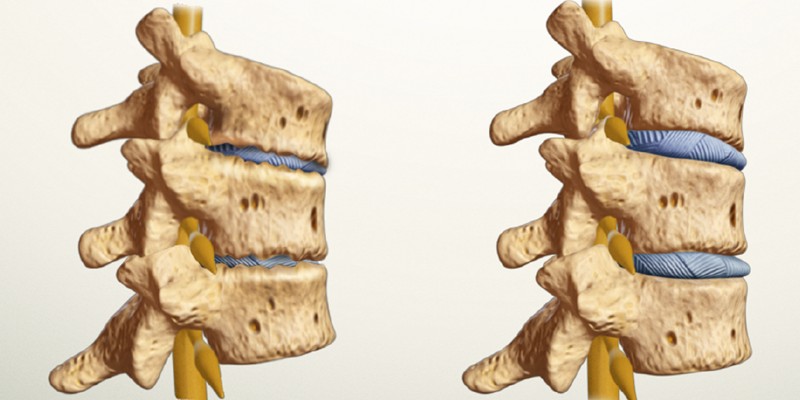 Болит спина болезни позвоночника