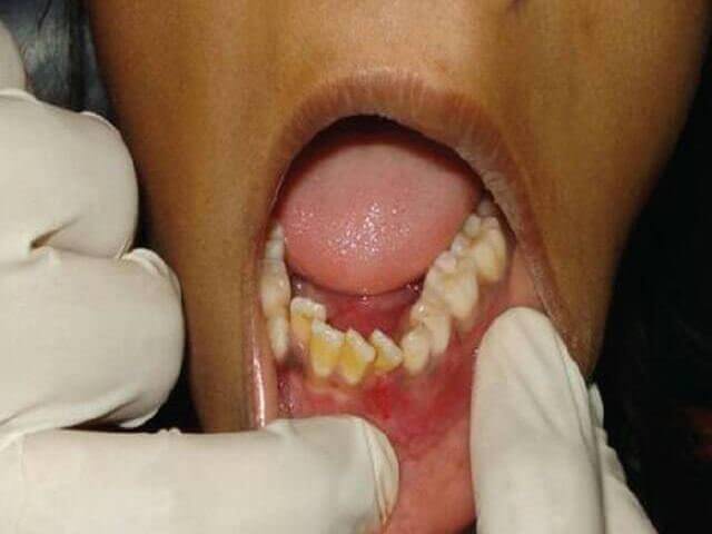 Сустав челюсти болит отдает в голову