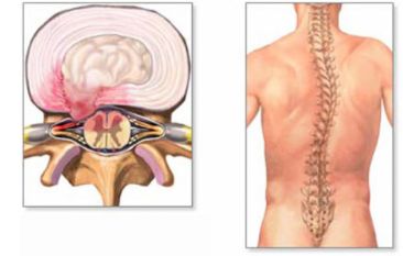 болит спина как посидишь
