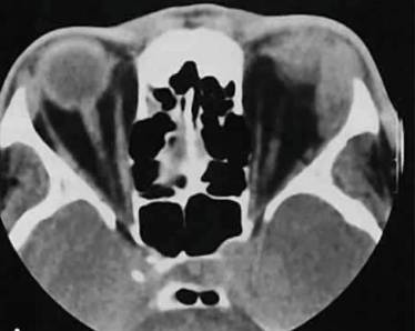 От чего может болеть спина и быть температура