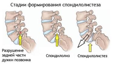 Почему болит спина в грудном отделе ночью