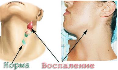 От чего может болеть спина и быть температура