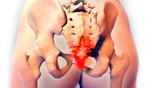 Болит копчик когда садишься на спину