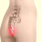 Если болит спина и копчик к какому врачу обратиться