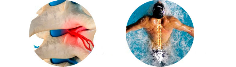 когда болит спина можно в бассейн