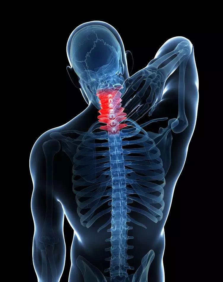 Хрустит шея и болит голова: Что делать? Хрустит шея и болит голова: Что делать?