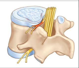 Хрустнула спина теперь болит что делать