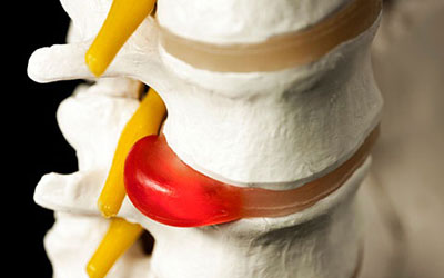 Почему болит спина в грудном отделе ночью