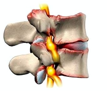 Почему болит спина в грудном отделе ночью