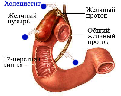 Если болит правый бок и отдает в спину как лечить