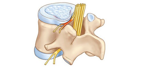 Почему при приседании болит спина