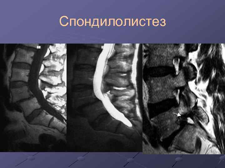 Болит копчик когда садишься на спину